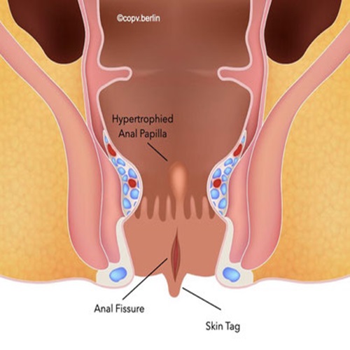 Laser Proctology Training Manufacturers in Ahmedabad