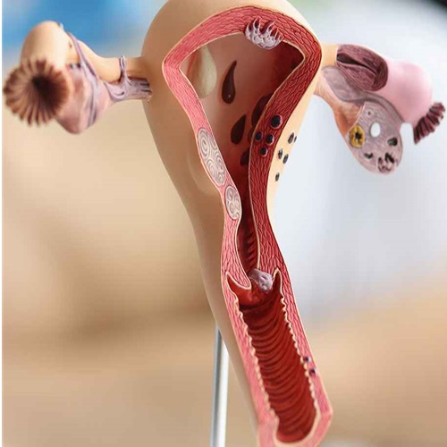 Laser Cosmetic Gynecology Training Manufacturers in Ahmedabad